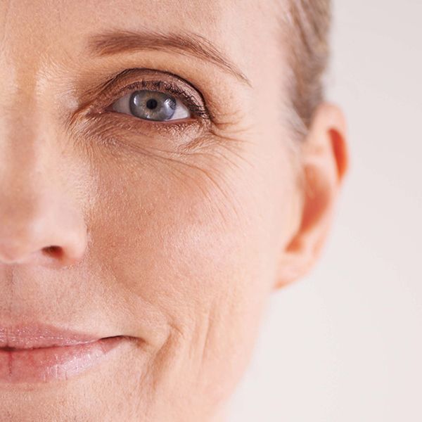 Menopausa